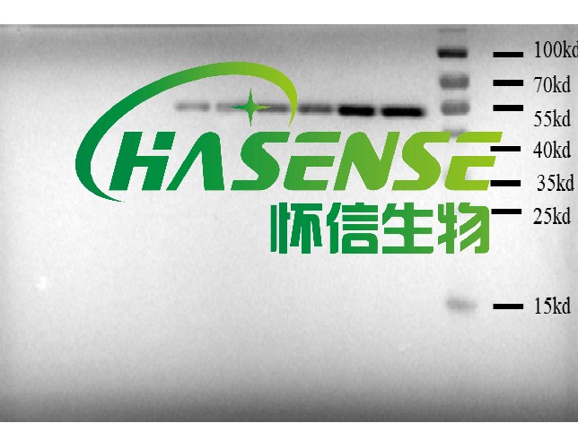 western-blot檢測(cè)